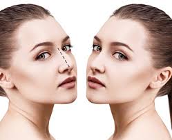 Non Surgical Dermal Fillers